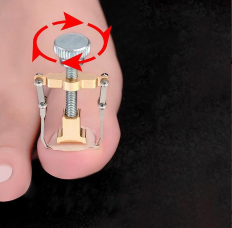 Professional Ingrown Toenail Correction Tool Nail Clamp Stainless Steel